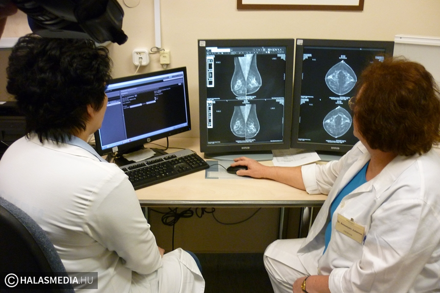 Mammográfiás szűrővizsgálatra hívják a halasi nőket