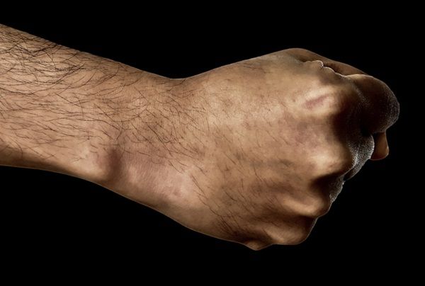 Életveszélyes fejsérülést okozott a halasi férfi