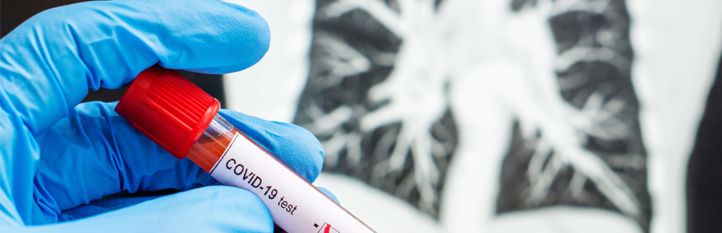 Hála istennek negatív lett, nincs baj!