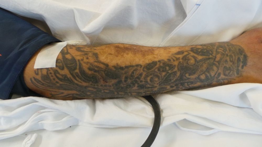 Felismeri a tetoválása alapján?