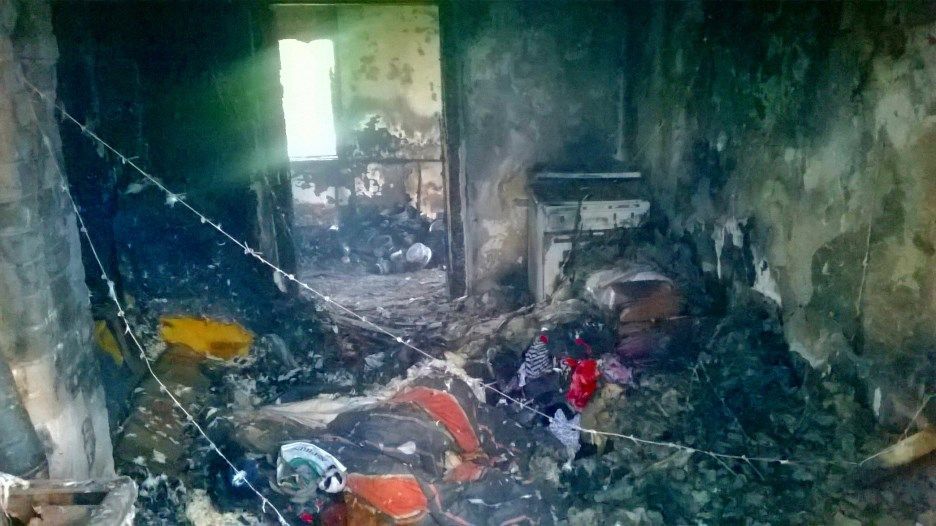 Hazaengedték a megégett asszonyt