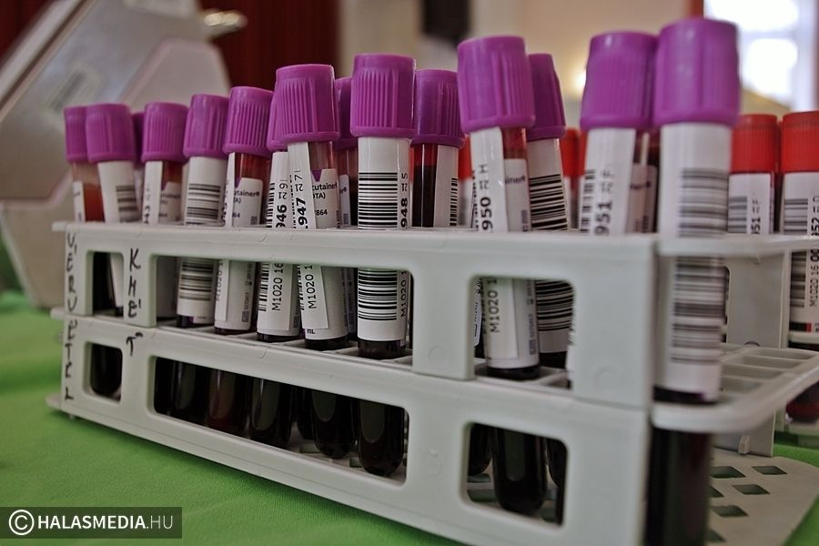 Véradás lesz augusztus első szerdáján, Halason